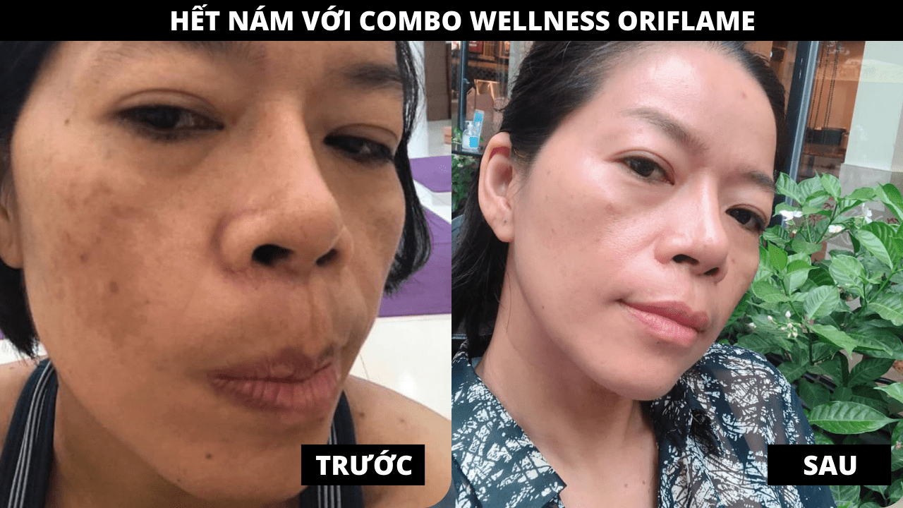 Cảm nhận khách hàng dùng Combo Wellness Oriflame