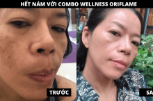 Cảm nhận khách hàng dùng Combo Wellness Oriflame